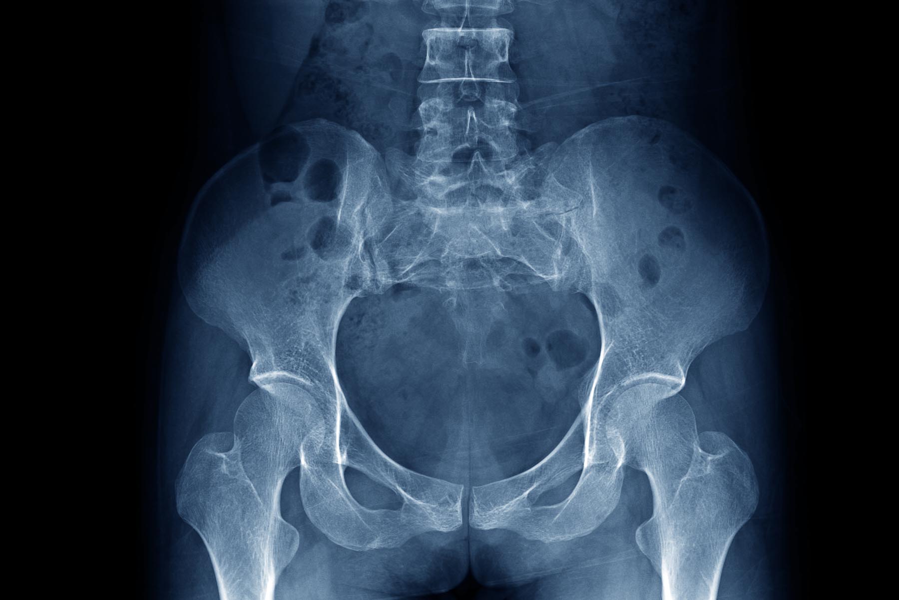 اختلال‌های میل و برانگیختگی جنسی